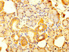 IHC image of CSB-PA021383LA01HU diluted at 1:300 and staining in paraffin-embedded human salivary gland tissue performed on a Leica BondTM system. After dewaxing and hydration, antigen retrieval was mediated by high pressure in a citrate buffer (pH 6.0) . Section was blocked with 10% normal goat serum 30min at RT. Then primary antibody (1% BSA) was incubated at 4°C overnight. The primary is detected by a biotinylated secondary antibody and visualized using an HRP conjugated SP system.