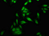 Immunofluorescence staining of Hela cells with CSB-PA024056LA01HU at 1:166, counter-stained with DAPI. The cells were fixed in 4% formaldehyde, permeabilized using 0.2% Triton X-100 and blocked in 10% normal Goat Serum. The cells were then incubated with the antibody overnight at 4°C. The secondary antibody was Alexa Fluor 488-congugated AffiniPure Goat Anti-Rabbit IgG (H+L) .