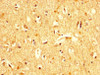 IHC image of CSB-PA025416LA01HU diluted at 1:200 and staining in paraffin-embedded human brain tissue performed on a Leica BondTM system. After dewaxing and hydration, antigen retrieval was mediated by high pressure in a citrate buffer (pH 6.0) . Section was blocked with 10% normal goat serum 30min at RT. Then primary antibody (1% BSA) was incubated at 4°C overnight. The primary is detected by a biotinylated secondary antibody and visualized using an HRP conjugated SP system.