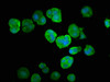 Immunofluorescence staining of MCF-7 cells with CSB-PA025416LA01HU at 1:66, counter-stained with DAPI. The cells were fixed in 4% formaldehyde, permeabilized using 0.2% Triton X-100 and blocked in 10% normal Goat Serum. The cells were then incubated with the antibody overnight at 4°C. The secondary antibody was Alexa Fluor 488-congugated AffiniPure Goat Anti-Rabbit IgG (H+L) .