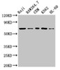 Western Blot<br />
 Positive WB detected in: Raji whole cell lysate, RAW264.7 whole cell lysate, CEM whole cell lysate, K562 whole cell lysate, HL60 whole cell lysate<br />
 All lanes: Zap70 antibody at 3.2µg/ml<br />
 Secondary<br />
 Goat polyclonal to rabbit IgG at 1/50000 dilution<br />
 Predicted band size: 71, 36 kDa<br />
 Observed band size: 71 kDa<br />