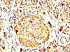 IHC image of CSB-PA12619A0Rb diluted at 1:400 and staining in paraffin-embedded human pancreatic tissue performed on a Leica BondTM system. After dewaxing and hydration, antigen retrieval was mediated by high pressure in a citrate buffer (pH 6.0) . Section was blocked with 10% normal goat serum 30min at RT. Then primary antibody (1% BSA) was incubated at 4°C overnight. The primary is detected by a biotinylated secondary antibody and visualized using an HRP conjugated SP system.