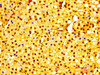 IHC image of CSB-PA529740LA01HU diluted at 1:300 and staining in paraffin-embedded human adrenal gland tissue performed on a Leica BondTM system. After dewaxing and hydration, antigen retrieval was mediated by high pressure in a citrate buffer (pH 6.0) . Section was blocked with 10% normal goat serum 30min at RT. Then primary antibody (1% BSA) was incubated at 4°C overnight. The primary is detected by a biotinylated secondary antibody and visualized using an HRP conjugated SP system.