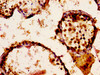 IHC image of CSB-PA613605LA01HU diluted at 1:300 and staining in paraffin-embedded human testis tissue performed on a Leica BondTM system. After dewaxing and hydration, antigen retrieval was mediated by high pressure in a citrate buffer (pH 6.0) . Section was blocked with 10% normal goat serum 30min at RT. Then primary antibody (1% BSA) was incubated at 4°C overnight. The primary is detected by a biotinylated secondary antibody and visualized using an HRP conjugated ABC system.
