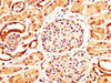 IHC image of CSB-PA615540LA01HU diluted at 1:400 and staining in paraffin-embedded human kidney tissue performed on a Leica BondTM system. After dewaxing and hydration, antigen retrieval was mediated by high pressure in a citrate buffer (pH 6.0) . Section was blocked with 10% normal goat serum 30min at RT. Then primary antibody (1% BSA) was incubated at 4°C overnight. The primary is detected by a biotinylated secondary antibody and visualized using an HRP conjugated SP system.