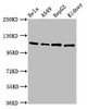 Western Blot<br />
 Positive WB detected in: Hela whole cell lysate, A549 whole cell lysate, HepG2 whole cell lysate, Rat kidney tissue<br />
 All lanes: NFATC3 antibody at 4.6µg/ml<br />
 Secondary<br />
 Goat polyclonal to rabbit IgG at 1/50000 dilution<br />
 Predicted band size: 116, 113, 78, 81 kDa<br />
 Observed band size: 116 kDa<br />