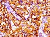 IHC image of CSB-PA621965LA01HU diluted at 1:100 and staining in paraffin-embedded human adrenal gland tissue performed on a Leica BondTM system. After dewaxing and hydration, antigen retrieval was mediated by high pressure in a citrate buffer (pH 6.0) . Section was blocked with 10% normal goat serum 30min at RT. Then primary antibody (1% BSA) was incubated at 4°C overnight. The primary is detected by a biotinylated secondary antibody and visualized using an HRP conjugated SP system.