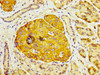 IHC image of CSB-PA621973LA01HU diluted at 1:200 and staining in paraffin-embedded human pancreatic tissue performed on a Leica BondTM system. After dewaxing and hydration, antigen retrieval was mediated by high pressure in a citrate buffer (pH 6.0) . Section was blocked with 10% normal goat serum 30min at RT. Then primary antibody (1% BSA) was incubated at 4°C overnight. The primary is detected by a biotinylated secondary antibody and visualized using an HRP conjugated SP system.