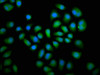 Immunofluorescence staining of Hela cells with CSB-PA621973LA01HU at 1:66, counter-stained with DAPI. The cells were fixed in 4% formaldehyde, permeabilized using 0.2% Triton X-100 and blocked in 10% normal Goat Serum. The cells were then incubated with the antibody overnight at 4°C. The secondary antibody was Alexa Fluor 488-congugated AffiniPure Goat Anti-Rabbit IgG (H+L) . Immunofluorescence staining of Hela cells with CSB-PA621973LA01HU at 1:66, counter-stained with DAPI. The cells were fixed in 4% formaldehyde, permeabilized using 0.2% Triton X-100 and blocked in 10% normal Goat Serum. The cells were then incubated with the antibody overnight at 4°C. The secondary antibody was Alexa Fluor 488-congugated AffiniPure Goat Anti-Rabbit IgG (H+L) .