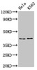 Western Blot<br />
 Positive WB detected in: Hela whole cell lysate, K562 whole cell lysate<br />
 All lanes: PCBP2 antibody at 5.3µg/ml<br />
 Secondary<br />
 Goat polyclonal to rabbit IgG at 1/50000 dilution<br />
 Predicted band size: 39, 35, 36, 34 kDa<br />
 Observed band size: 43 kDa<br />