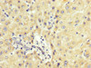 IHC image of CSB-PA622995LA01HU diluted at 1:200 and staining in paraffin-embedded human liver tissue performed on a Leica BondTM system. After dewaxing and hydration, antigen retrieval was mediated by high pressure in a citrate buffer (pH 6.0) . Section was blocked with 10% normal goat serum 30min at RT. Then primary antibody (1% BSA) was incubated at 4°C overnight. The primary is detected by a biotinylated secondary antibody and visualized using an HRP conjugated SP system.