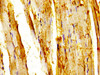 IHC image of CSB-PA757671LA01HU diluted at 1:200 and staining in paraffin-embedded human skeletal muscle tissue performed on a Leica BondTM system. After dewaxing and hydration, antigen retrieval was mediated by high pressure in a citrate buffer (pH 6.0) . Section was blocked with 10% normal goat serum 30min at RT. Then primary antibody (1% BSA) was incubated at 4°C overnight. The primary is detected by a biotinylated secondary antibody and visualized using an HRP conjugated SP system.
