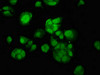 Immunofluorescence staining of MCF-7 cells with CSB-PA761627LA01HU at 1:100, counter-stained with DAPI. The cells were fixed in 4% formaldehyde, permeabilized using 0.2% Triton X-100 and blocked in 10% normal Goat Serum. The cells were then incubated with the antibody overnight at 4°C. The secondary antibody was Alexa Fluor 488-congugated AffiniPure Goat Anti-Rabbit IgG (H+L) .