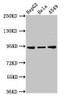 Western Blot<br />
 Positive WB detected in: HepG2 whole cell lysate, Hela whole cell lysate, A549 whole cell lysate<br />
 All lanes: CHD1L antibody at 3µg/ml<br />
 Secondary<br />
 Goat polyclonal to rabbit IgG at 1/50000 dilution<br />
 Predicted band size: 101, 91, 78, 89, 70 kDa<br />
 Observed band size: 91 kDa<br />