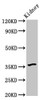 Western Blot<br />
 Positive WB detected in: Mouse kidney tissue<br />
 All lanes: GPBAR1 antibody at 6µg/ml<br />
 Secondary<br />
 Goat polyclonal to rabbit IgG at 1/50000 dilution<br />
 Predicted band size: 36 kDa<br />
 Observed band size: 36 kDa<br />