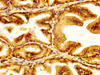 IHC image of CSB-PA836239LA01HU diluted at 1:300 and staining in paraffin-embedded human prostate tissue performed on a Leica BondTM system. After dewaxing and hydration, antigen retrieval was mediated by high pressure in a citrate buffer (pH 6.0) . Section was blocked with 10% normal goat serum 30min at RT. Then primary antibody (1% BSA) was incubated at 4°C overnight. The primary is detected by a biotinylated secondary antibody and visualized using an HRP conjugated SP system.