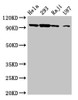 Western Blot<br />
 Positive WB detected in: Hela whole cell lysate, 293 whole cell lysate, Raji whole cell lysate, U87 whole cell lysate<br />
 All lanes: MASTL antibody at 6.3µg/ml<br />
 Secondary<br />
 Goat polyclonal to rabbit IgG at 1/50000 dilution<br />
 Predicted band size: 98, 93 kDa<br />
 Observed band size: 98 kDa<br />