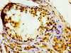 IHC image of CSB-PA846629LA01HU diluted at 1:200 and staining in paraffin-embedded human testis tissue performed on a Leica BondTM system. After dewaxing and hydration, antigen retrieval was mediated by high pressure in a citrate buffer (pH 6.0) . Section was blocked with 10% normal goat serum 30min at RT. Then primary antibody (1% BSA) was incubated at 4°C overnight. The primary is detected by a biotinylated secondary antibody and visualized using an HRP conjugated SP system.