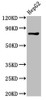 Western Blot<br />
 Positive WB detected in: HepG2 whole cell lysate<br />
 All lanes: PROX1 antibody at 3µg/ml<br />
 Secondary<br />
 Goat polyclonal to rabbit IgG at 1/50000 dilution<br />
 Predicted band size: 84 kDa<br />
 Observed band size: 84 kDa<br />