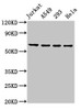 Western Blot<br />
 Positive WB detected in: Jurkat whole cell lysate, A549 whole cell lysate, 293 whole cell lysate, Hela whole cell lysate<br />
 All lanes: TAF15 antibody at 8.5µg/ml<br />
 Secondary<br />
 Goat polyclonal to rabbit IgG at 1/50000 dilution<br />
 Predicted band size: 62 kDa<br />
 Observed band size: 62 kDa<br /> Western Blot<br />
 Positive WB detected in: Jurkat whole cell lysate, A549 whole cell lysate, 293 whole cell lysate, Hela whole cell lysate<br />
 All lanes: TAF15 antibody at 8.5µg/ml<br />
 Secondary<br />
 Goat polyclonal to rabbit IgG at 1/50000 dilution<br />
 Predicted band size: 62 kDa<br />
 Observed band size: 62 kDa<br />