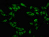Immunofluorescence staining of Hela cells with CSB-PA856431LA01HU at 1:100, counter-stained with DAPI. The cells were fixed in 4% formaldehyde, permeabilized using 0.2% Triton X-100 and blocked in 10% normal Goat Serum. The cells were then incubated with the antibody overnight at 4°C. The secondary antibody was Alexa Fluor 488-congugated AffiniPure Goat Anti-Rabbit IgG (H+L) . Immunofluorescence staining of Hela cells with CSB-PA856431LA01HU at 1:100, counter-stained with DAPI. The cells were fixed in 4% formaldehyde, permeabilized using 0.2% Triton X-100 and blocked in 10% normal Goat Serum. The cells were then incubated with the antibody overnight at 4°C. The secondary antibody was Alexa Fluor 488-congugated AffiniPure Goat Anti-Rabbit IgG (H+L) .