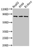 Western Blot<br />
 Positive WB detected in: HepG2 whole cell lysate, A549 whole cell lysate, Rat kidney tissue<br />
 All lanes: UIMC1 antibody at 3µg/ml<br />
 Secondary<br />
 Goat polyclonal to rabbit IgG at 1/50000 dilution<br />
 Predicted band size: 80, 62, 71, 39, 18 kDa<br />
 Observed band size: 80 kDa<br />