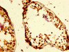 IHC image of CSB-PA857019LA01HU diluted at 1:500 and staining in paraffin-embedded human testis tissue performed on a Leica BondTM system. After dewaxing and hydration, antigen retrieval was mediated by high pressure in a citrate buffer (pH 6.0) . Section was blocked with 10% normal goat serum 30min at RT. Then primary antibody (1% BSA) was incubated at 4°C overnight. The primary is detected by a biotinylated secondary antibody and visualized using an HRP conjugated SP system.
