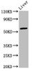 Western Blot<br />
 Positive WB detected in: Mouse liver tissue<br />
 All lanes: ARID3A antibody at 2.7µg/ml<br />
 Secondary<br />
 Goat polyclonal to rabbit IgG at 1/50000 dilution<br />
 Predicted band size: 63 kDa<br />
 Observed band size: 63 kDa<br />