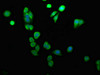 Immunofluorescence staining of HepG2 cells with CSB-PA858728LA01HU at 1:100, counter-stained with DAPI. The cells were fixed in 4% formaldehyde, permeabilized using 0.2% Triton X-100 and blocked in 10% normal Goat Serum. The cells were then incubated with the antibody overnight at 4°C. The secondary antibody was Alexa Fluor 488-congugated AffiniPure Goat Anti-Rabbit IgG (H+L) .