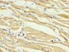 IHC image of CSB-PA861144LA01HU diluted at 1:400 and staining in paraffin-embedded human heart tissue performed on a Leica BondTM system. After dewaxing and hydration, antigen retrieval was mediated by high pressure in a citrate buffer (pH 6.0) . Section was blocked with 10% normal goat serum 30min at RT. Then primary antibody (1% BSA) was incubated at 4°C overnight. The primary is detected by a biotinylated secondary antibody and visualized using an HRP conjugated SP system.