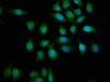 Immunofluorescence staining of A549 cells with CSB-PA861144LA01HU at 1:133, counter-stained with DAPI. The cells were fixed in 4% formaldehyde, permeabilized using 0.2% Triton X-100 and blocked in 10% normal Goat Serum. The cells were then incubated with the antibody overnight at 4°C. The secondary antibody was Alexa Fluor 488-congugated AffiniPure Goat Anti-Rabbit IgG (H+L) .