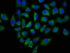 Immunofluorescence staining of A549 cells with CSB-PA862003LA01HU at 1:166, counter-stained with DAPI. The cells were fixed in 4% formaldehyde, permeabilized using 0.2% Triton X-100 and blocked in 10% normal Goat Serum. The cells were then incubated with the antibody overnight at 4°C. The secondary antibody was Alexa Fluor 488-congugated AffiniPure Goat Anti-Rabbit IgG (H+L) .