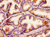 IHC image of CSB-PA863972LA01HU diluted at 1:500 and staining in paraffin-embedded human prostate tissue performed on a Leica BondTM system. After dewaxing and hydration, antigen retrieval was mediated by high pressure in a citrate buffer (pH 6.0) . Section was blocked with 10% normal goat serum 30min at RT. Then primary antibody (1% BSA) was incubated at 4°C overnight. The primary is detected by a biotinylated secondary antibody and visualized using an HRP conjugated ABC system.