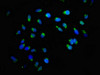 Immunofluorescence staining of Hela cells with CSB-PA863972LA01HU at 1:166, counter-stained with DAPI. The cells were fixed in 4% formaldehyde, permeabilized using 0.2% Triton X-100 and blocked in 10% normal Goat Serum. The cells were then incubated with the antibody overnight at 4°C. The secondary antibody was Alexa Fluor 488-congugated AffiniPure Goat Anti-Rabbit IgG (H+L) .