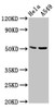 Western Blot<br />
 Positive WB detected in: Hela whole cell lysate, A549 whole cell lysate<br />
 All lanes: CHRDL1 antibody at 5.7µg/ml<br />
 Secondary<br />
 Goat polyclonal to rabbit IgG at 1/50000 dilution<br />
 Predicted band size: 52, 44, 53 kDa<br />
 Observed band size: 52 kDa<br />