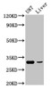 Western Blot<br />
 Positive WB detected in: U87 whole cell lysate, Rat liver tissue<br />
 All lanes: ITM2B antibody at 4.9µg/ml<br />
 Secondary<br />
 Goat polyclonal to rabbit IgG at 1/50000 dilution<br />
 Predicted band size: 54 kDa<br />
 Observed band size: 31 kDa<br />