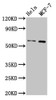 Western Blot<br />
 Positive WB detected in: Hela whole cell lysate, MCF-7 whole cell lysate<br />
 All lanes: MMP28 antibody at 3.2µg/ml<br />
 Secondary<br />
 Goat polyclonal to rabbit IgG at 1/50000 dilution<br />
 Predicted band size: 59, 15 kDa<br />
 Observed band size: 59 kDa<br />