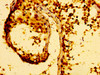 IHC image of CSB-PA880950LA01HU diluted at 1:100 and staining in paraffin-embedded human testis tissue performed on a Leica BondTM system. After dewaxing and hydration, antigen retrieval was mediated by high pressure in a citrate buffer (pH 6.0) . Section was blocked with 10% normal goat serum 30min at RT. Then primary antibody (1% BSA) was incubated at 4°C overnight. The primary is detected by a biotinylated secondary antibody and visualized using an HRP conjugated SP system.