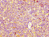 IHC image of CSB-PA887972LA01HU diluted at 1:400 and staining in paraffin-embedded human lymph node tissue performed on a Leica BondTM system. After dewaxing and hydration, antigen retrieval was mediated by high pressure in a citrate buffer (pH 6.0) . Section was blocked with 10% normal goat serum 30min at RT. Then primary antibody (1% BSA) was incubated at 4°C overnight. The primary is detected by a biotinylated secondary antibody and visualized using an HRP conjugated SP system. IHC image of CSB-PA887972LA01HU diluted at 1:400 and staining in paraffin-embedded human lymph node tissue performed on a Leica BondTM system. After dewaxing and hydration, antigen retrieval was mediated by high pressure in a citrate buffer (pH 6.0) . Section was blocked with 10% normal goat serum 30min at RT. Then primary antibody (1% BSA) was incubated at 4°C overnight. The primary is detected by a biotinylated secondary antibody and visualized using an HRP conjugated SP system.