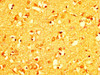 IHC image of CSB-PA892347LA01HU diluted at 1:200 and staining in paraffin-embedded human brain tissue performed on a Leica BondTM system. After dewaxing and hydration, antigen retrieval was mediated by high pressure in a citrate buffer (pH 6.0) . Section was blocked with 10% normal goat serum 30min at RT. Then primary antibody (1% BSA) was incubated at 4°C overnight. The primary is detected by a biotinylated secondary antibody and visualized using an HRP conjugated SP system.