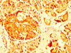 IHC image of CSB-PA892347LA01HU diluted at 1:200 and staining in paraffin-embedded human pancreatic tissue performed on a Leica BondTM system. After dewaxing and hydration, antigen retrieval was mediated by high pressure in a citrate buffer (pH 6.0) . Section was blocked with 10% normal goat serum 30min at RT. Then primary antibody (1% BSA) was incubated at 4°C overnight. The primary is detected by a biotinylated secondary antibody and visualized using an HRP conjugated SP system.