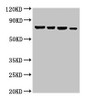 Western Blot<br />
 Positive WB detected in: Hela whole cell lysate, U87 whole cell lysate, 293T whole cell lysate, Jurkat whole cell lysate<br />
 All lanes: NFE2L3 antibody at 3µg/ml<br />
 Secondary<br />
 Goat polyclonal to rabbit IgG at 1/50000 dilution<br />
 Predicted band size: 77 kDa<br />
 Observed band size: 77 kDa<br />