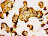 IHC image of CSB-PA896721LA01HU diluted at 1:500 and staining in paraffin-embedded human placenta tissue performed on a Leica BondTM system. After dewaxing and hydration, antigen retrieval was mediated by high pressure in a citrate buffer (pH 6.0) . Section was blocked with 10% normal goat serum 30min at RT. Then primary antibody (1% BSA) was incubated at 4°C overnight. The primary is detected by a biotinylated secondary antibody and visualized using an HRP conjugated SP system.