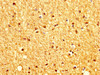 IHC image of CSB-PA896928LA01HU diluted at 1:200 and staining in paraffin-embedded human brain tissue performed on a Leica BondTM system. After dewaxing and hydration, antigen retrieval was mediated by high pressure in a citrate buffer (pH 6.0) . Section was blocked with 10% normal goat serum 30min at RT. Then primary antibody (1% BSA) was incubated at 4°C overnight. The primary is detected by a biotinylated secondary antibody and visualized using an HRP conjugated SP system.