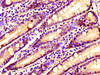 IHC image of CSB-PA897526LA01HU diluted at 1:100 and staining in paraffin-embedded human small intestine tissue performed on a Leica BondTM system. After dewaxing and hydration, antigen retrieval was mediated by high pressure in a citrate buffer (pH 6.0) . Section was blocked with 10% normal goat serum 30min at RT. Then primary antibody (1% BSA) was incubated at 4°C overnight. The primary is detected by a biotinylated secondary antibody and visualized using an HRP conjugated SP system.