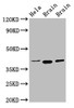 Western Blot<br />
 Positive WB detected in: Hela whole cell lysate, Rat brain tissue, Mouse brain tissue<br />
 All lanes: ERGIC2 antibody at 2.5µg/ml<br />
 Secondary<br />
 Goat polyclonal to rabbit IgG at 1/50000 dilution<br />
 Predicted band size: 43 kDa<br />
 Observed band size: 43 kDa<br />