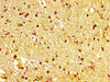 IHC image of CSB-PA859102LA01HU diluted at 1:600 and staining in paraffin-embedded human brain tissue performed on a Leica BondTM system. After dewaxing and hydration, antigen retrieval was mediated by high pressure in a citrate buffer (pH 6.0) . Section was blocked with 10% normal goat serum 30min at RT. Then primary antibody (1% BSA) was incubated at 4°C overnight. The primary is detected by a biotinylated secondary antibody and visualized using an HRP conjugated SP system.