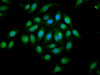 Immunofluorescence staining of A549 cells with CSB-PA007722LA01HU at 1:133, counter-stained with DAPI. The cells were fixed in 4% formaldehyde, permeabilized using 0.2% Triton X-100 and blocked in 10% normal Goat Serum. The cells were then incubated with the antibody overnight at 4°C. The secondary antibody was Alexa Fluor 488-congugated AffiniPure Goat Anti-Rabbit IgG (H+L) .