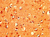 IHC image of CSB-PA015389LA01HU diluted at 1:400 and staining in paraffin-embedded human brain tissue performed on a Leica BondTM system. After dewaxing and hydration, antigen retrieval was mediated by high pressure in a citrate buffer (pH 6.0) . Section was blocked with 10% normal goat serum 30min at RT. Then primary antibody (1% BSA) was incubated at 4°C overnight. The primary is detected by a biotinylated secondary antibody and visualized using an HRP conjugated SP system.