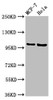 Western Blot<br />
 Positive WB detected in: MCF-7 whole cell lysate, Hela whole cell lysate<br />
 All lanes: NUP98 antibody at 3.2µg/ml<br />
 Secondary<br />
 Goat polyclonal to rabbit IgG at 1/50000 dilution<br />
 Predicted band size: 198, 188, 98, 97, 196, 187 kDa<br />
 Observed band size: 105 kDa<br />
